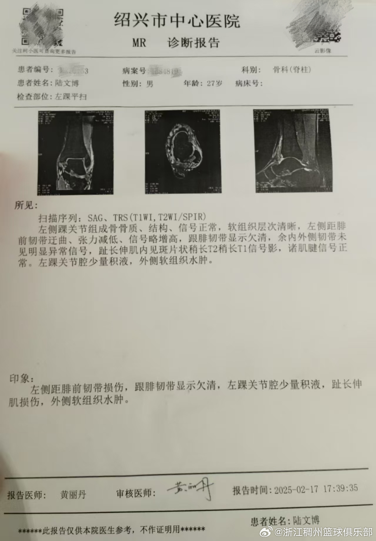 一對一單打